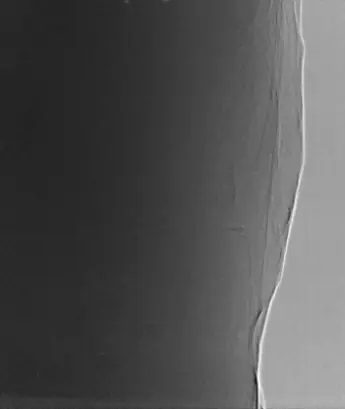 Dissection propagation in 2D X-ray