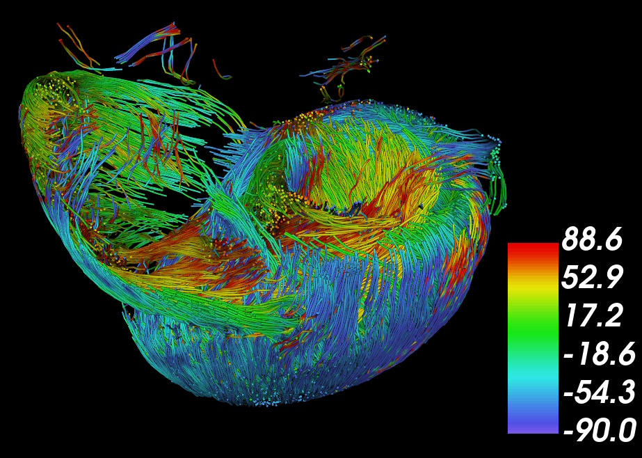 Cardiotensor streamline tractography