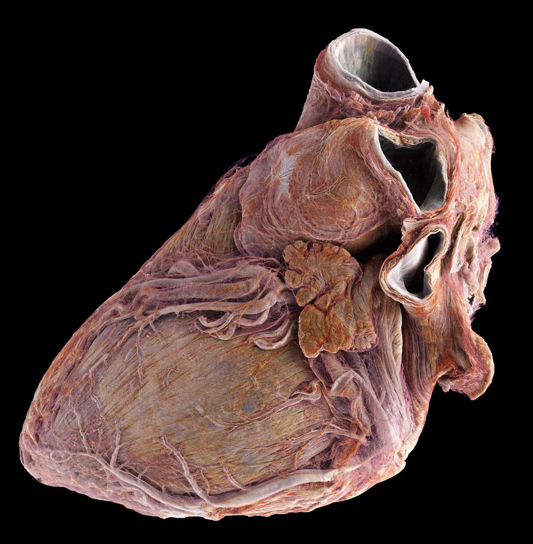 3D rendering of a heart