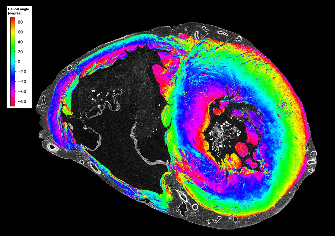 Mid-ventricular short-axis section of the ventricles in the control heart shows the feasibility of myomapping the orientation of myocyte aggregates