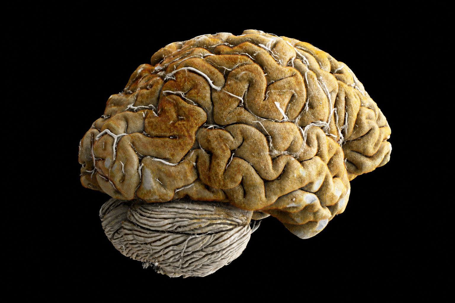 Three-dimensional rendering of an intact human brain on a black background